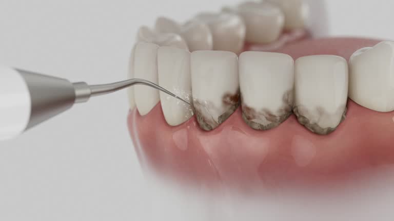 Reliable Dental Implants contractor in Bexley, OH by Smile Center Dentistry